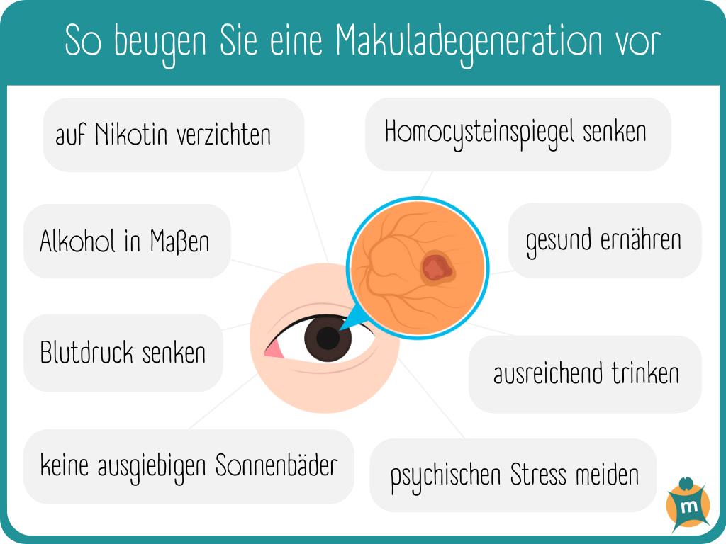 Infografik Makuladegeneration