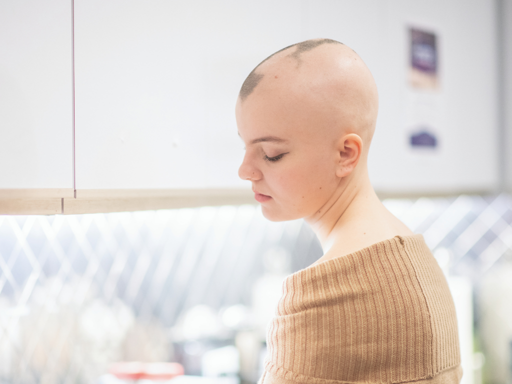 Mädchen mit kreisrundem Haarausfall