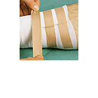 SILKAFIX Heftpfl.1,25 cmx9,2 m Pappkern - 24Stk