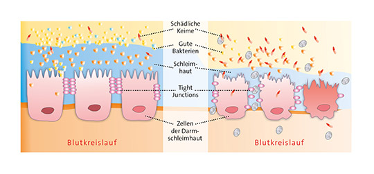 1201702_Infografik_Darmschleimhaut_(C)IA.jpg