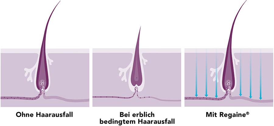 5-REGAINE_Wirkweise-Frauen_770px.jpg