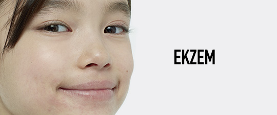 DERMOCAT_Banner_Ekzem.jpg