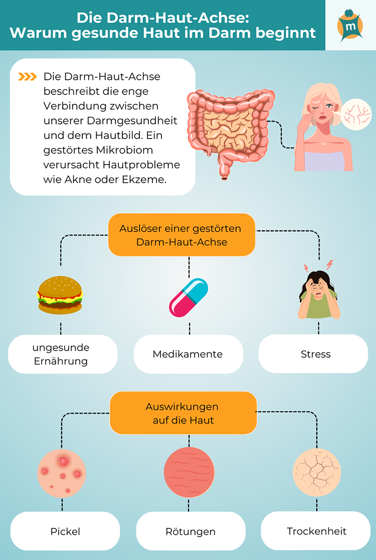 Themenshop_Haut-Darm-Achse_b1.png