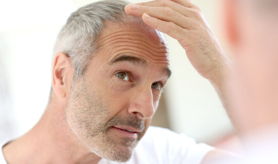 Mann der im Spiegel seine Geheimratsecken anschaut und auf der Suche nach einem Mittel gegen Haarausfall ist