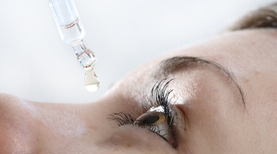 Frau tropft kontaktlinsen-verträgliche Augentropfen in das linke Auge. 