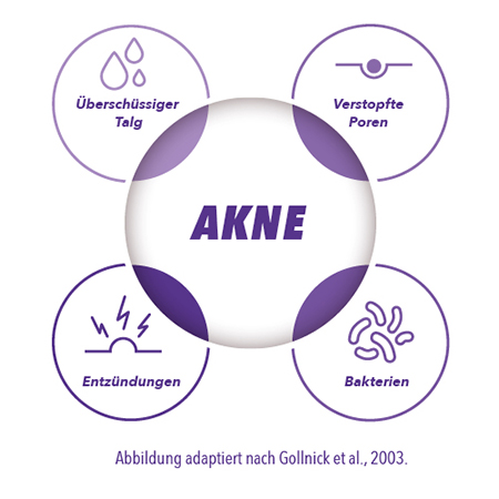ms_Benzaknen_Aknekreislauf.jpg