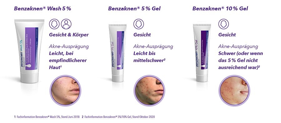 ms_Benzaknen_Uebersicht.jpg