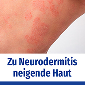 ms_linola_neurodermitis_kachel.jpg
