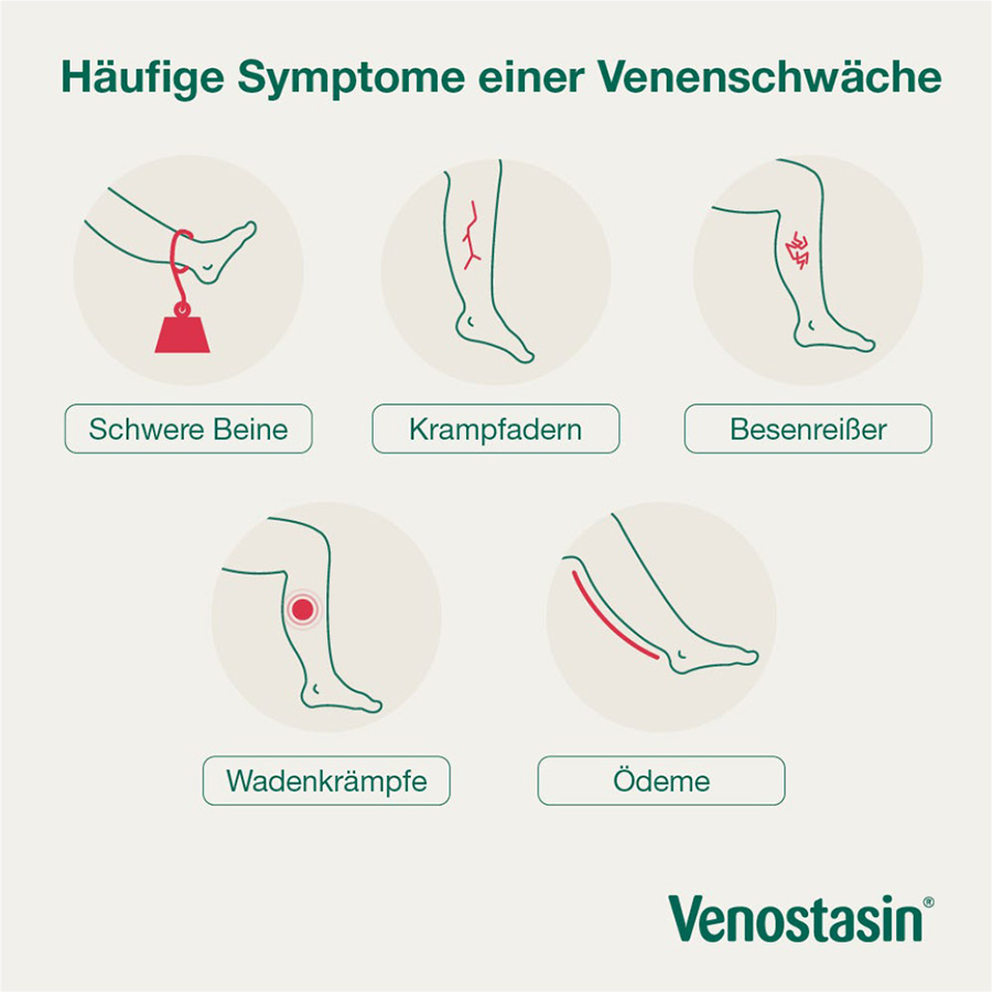 Häufige Symptome einer Venenschwäche