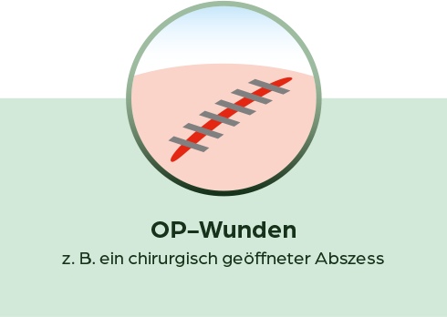 pds_19238537_OP-Wunden.png
