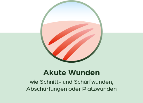 pds_19238537_akute_wunden.png