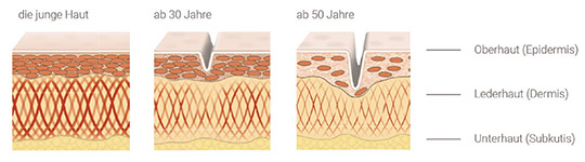 pds_a4impulse_faltenbildung.jpg