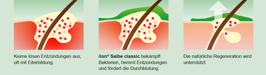 pds_ilonSalbeclassic_wirkprinzip.png