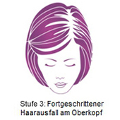 pds_regaine_frauenloesung_stufe3.jpg