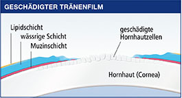 themenshop_trockenes-auge_bepanthen-traenenfilm-geschaedigt.jpg