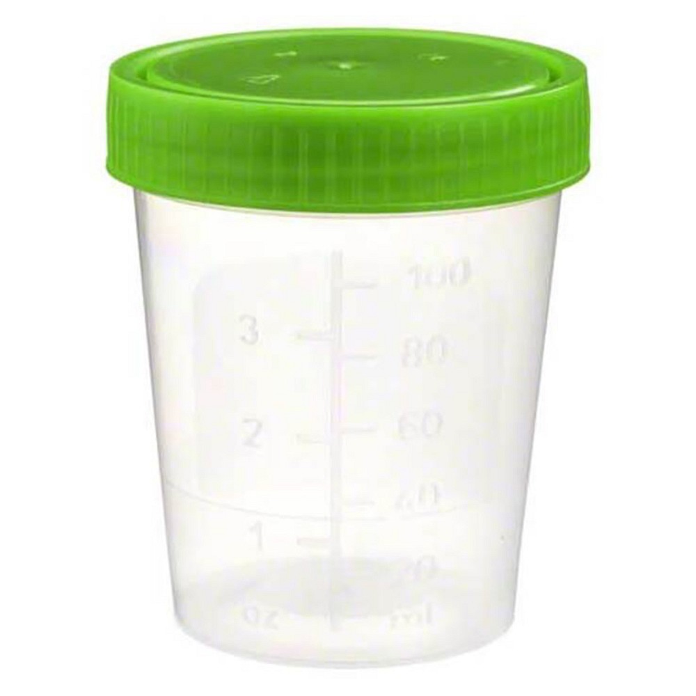 URINBECHER mit Schraubdeckel - 1Stk - Urinbecher, Urin- & Stuhltests