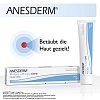 ANESDERM 25 mg/g + 25 mg/g Creme - 30g